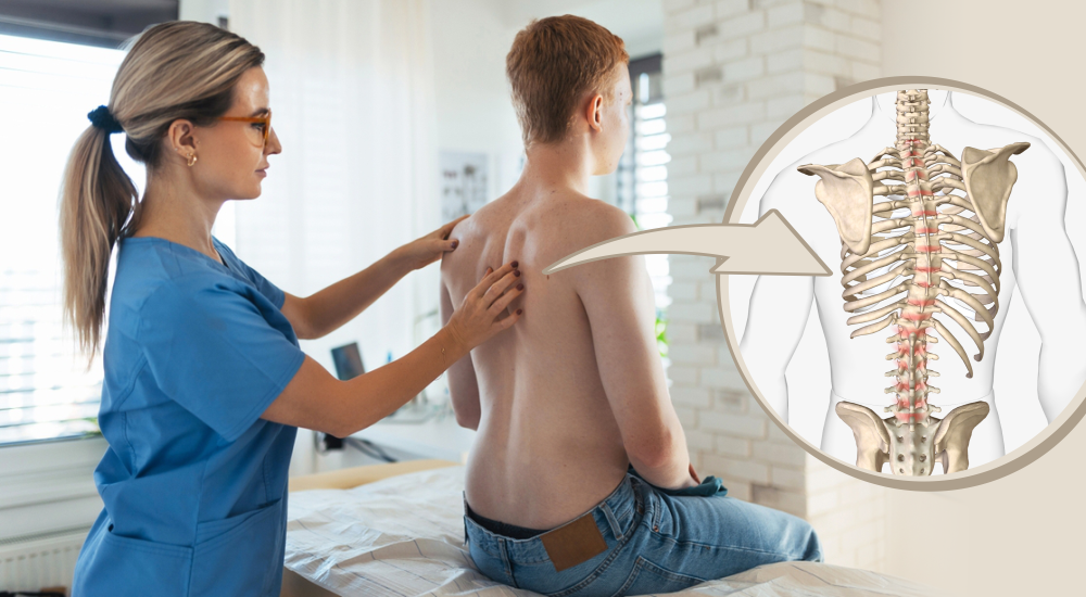 escoliose em adolescentes o que observar