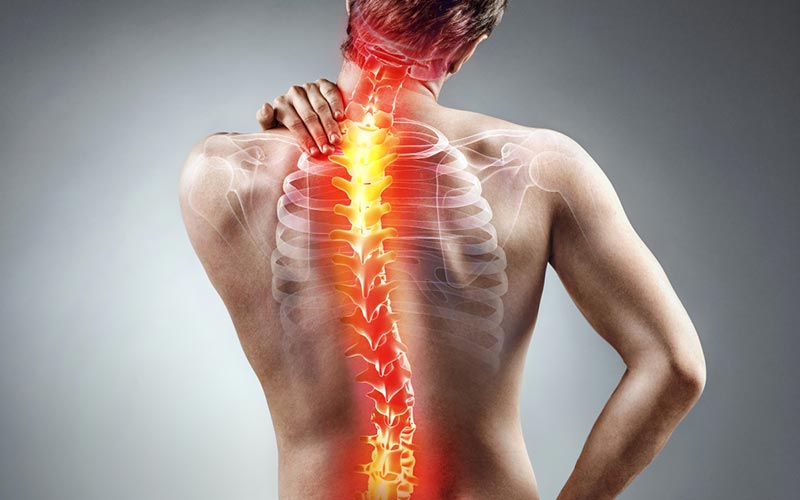 O que pode ser a dor nas costas?